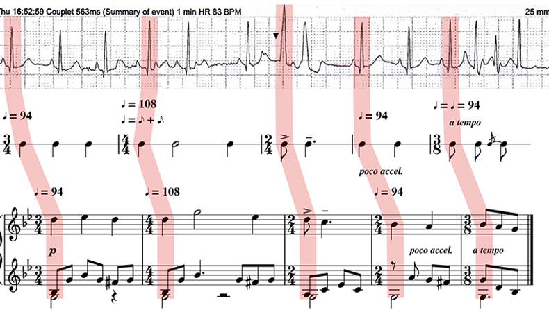 3273-Figure3-Arrhythmia.png