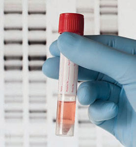 test-tube