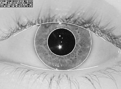 biometric-iris-pattern