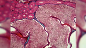 efferent_ductules_epididymis_in_cartilaginous_fish
