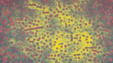 Hepatitis-B-virus