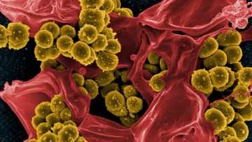 Micrograph of Methicillin-Resistant Staphylococcus aureus (MRSA)