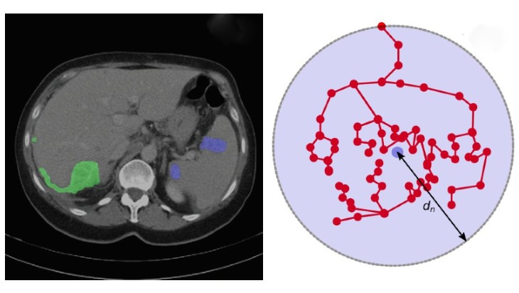 Figure 2: Examples of modelling cancer growth