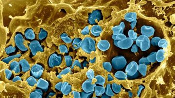 Macrophage_Infected_with_Francisella_tularensis_Bacteria