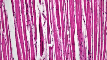 100x magnified cross section of cardiac muscle tissue. A series of lines in shades of red and white, with black dots amongst them.
