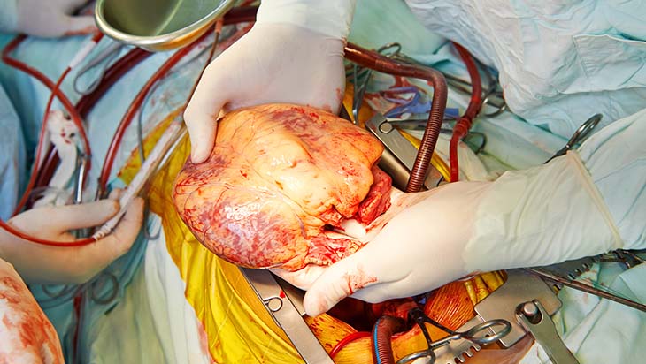 heart surgery